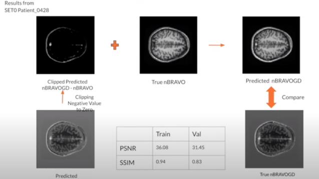 Multiple brain MRI scans