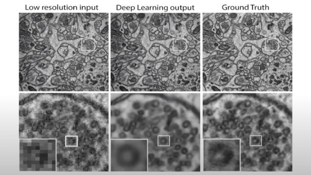 Six microscopy images of the brain