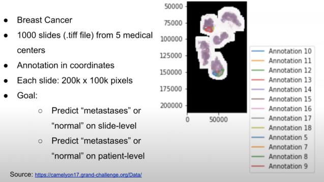 Slide showing breast cancer cells and notes